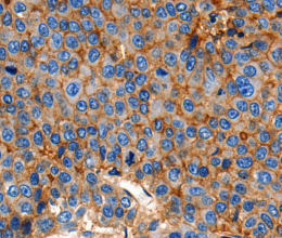 Claudin 1 Polyclonal Antibody - 2