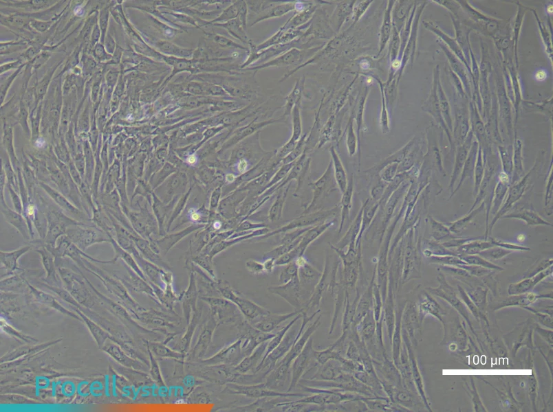 Human Oral Mucosal Fibroblast Complete Medium - 1
