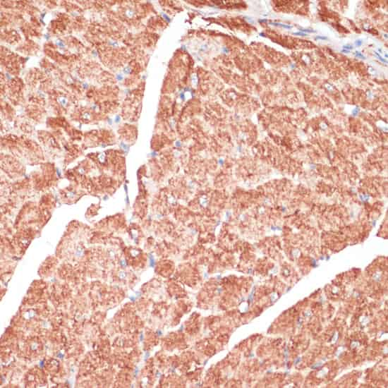 Immunohistochemistry of paraffin-embedded Mouse heart using DES Polyclonal Antibody at dilution of  1:100 (40x lens).