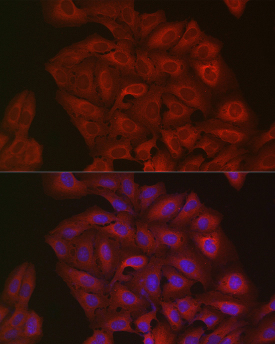 Immunofluorescence analysis of U2OS cells using Ubiquitin Polyclonal Antibody at dilution of 1:50 (40x lens). Blue: DAPI for nuclear staining.