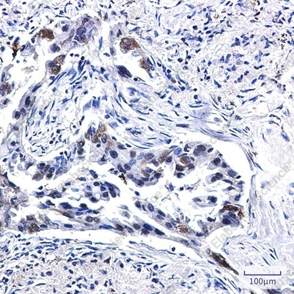Recombinant Tissue Factor Monoclonal Antibody - 3