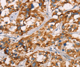 SPR Polyclonal Antibody - 3