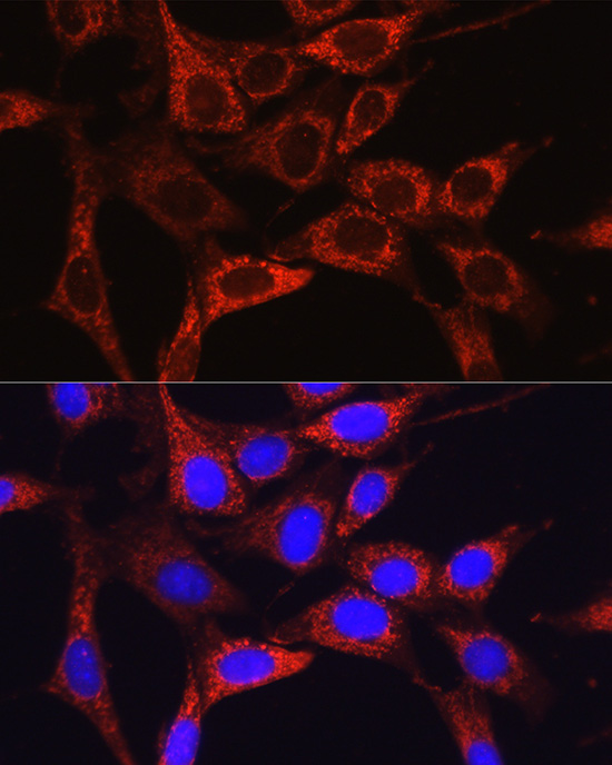 Immunofluorescence analysis of NIH/3T3 cells using [KO Validated] Glutamine Synthetase Polyclonal Antibody at dilution of 1:100 (40x lens). Blue: DAPI for nuclear staining.