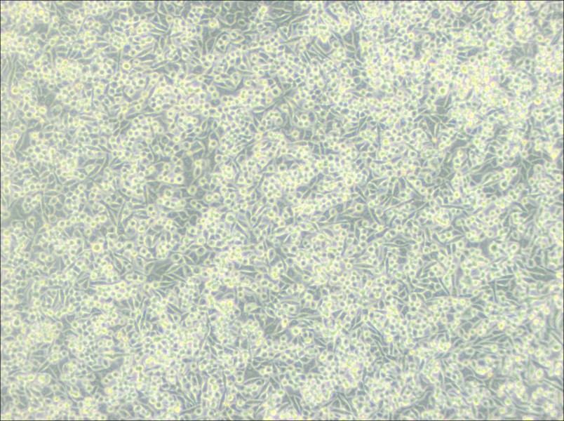 A-204 [A204] Cell Complete MediumA-204 [A204] Cell Complete Medium - 2