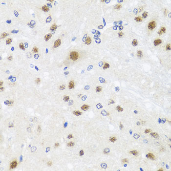 Immunohistochemistry of paraffin-embedded Rat brain using CETN3 Polyclonal Antibody at dilution of  1:100 (40x lens).