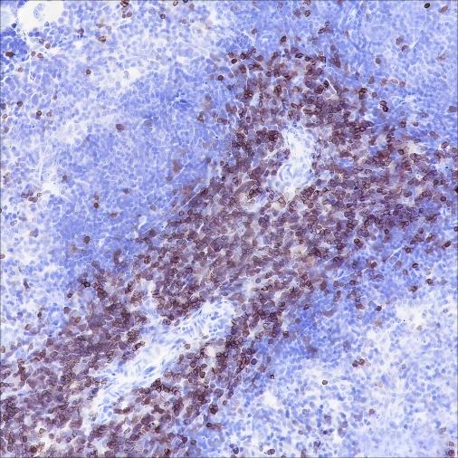 Recombinant CD3 epsilon Monoclonal Antibody - small - 5