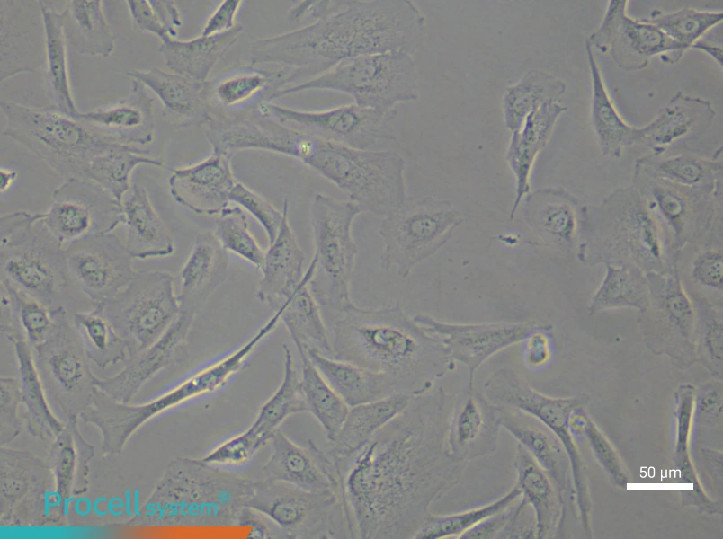 Human Keloid Fibroblast (Primary cell immortalization) Complete MediumHuman Keloid Fibroblast (Primary cell immortalization) Complete Medium - 4