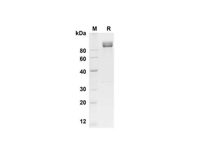 Recombinant Rat IL-17A Protein(Halo Tag)-产品推荐-1