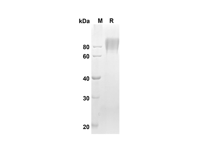 Recombinant Human CD14 Protein(His Tag)-产品推荐-1
