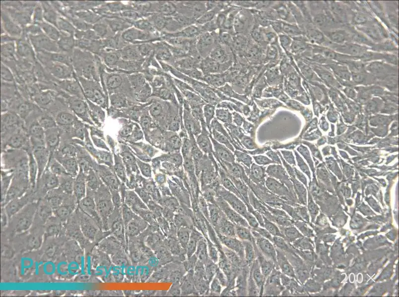 NCI-H2444 Cell Complete Medium - 5