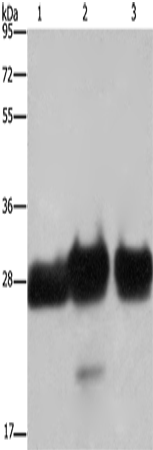 Western Blot analysis of Human adrenal pheochromocytoma, fetal muscle and skeletal muscle tissue   using FHL1 Polyclonal Antibody at dilution of 1:500