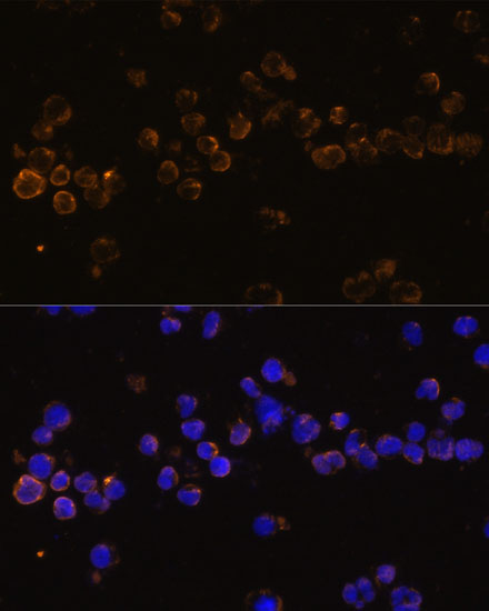 Immunofluorescence analysis of Jurkat cells using KLRC4 Polyclonal Antibody at dilution of  1:100 (40x lens). Blue: DAPI for nuclear staining.