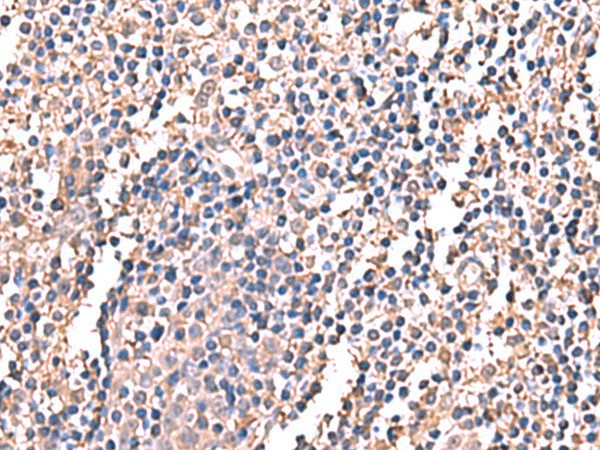 Immunohistochemistry of paraffin-embedded Human tonsil tissue  using LDHAL6B Polyclonal Antibody at dilution of 1:60(?200)