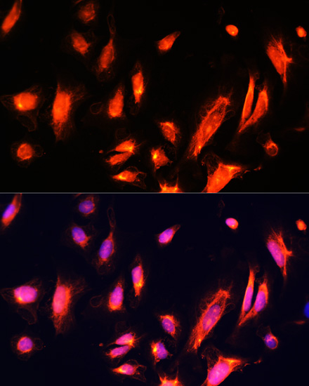 Immunofluorescence analysis of U-2 OS cells using ARL4A Polyclonal Antibody at dilution of  1:100. Blue: DAPI for nuclear staining.