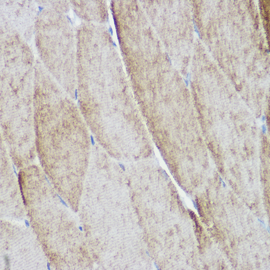 Immunohistochemistry of paraffin-embedded mouse skeletal muscle using ACTN3 Polyclonal Antibody at dilution of 1:500 (40x lens).Perform high pressure antigen retrieval with 10 mM citrate buffer pH 6.0 before commencing with IHC staining protocol.