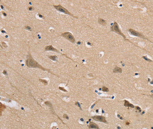 Immunohistochemistry of paraffin-embedded Human brain tissue using DLG2 Polyclonal Antibody at dilution 1:40