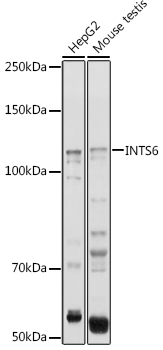 Western blot analysis of extracts of various cell lines using INTS6 Polyclonal Antibody at 1:1000 dilution.