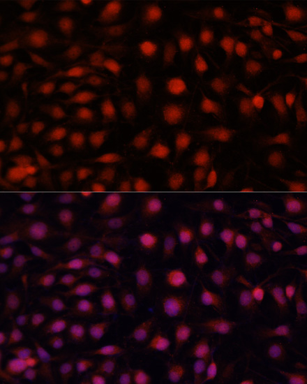 Immunofluorescence analysis of HUVEC cells using eNOS Polyclonal Antibody at dilution of  1:100 (40x lens). Blue: DAPI for nuclear staining.