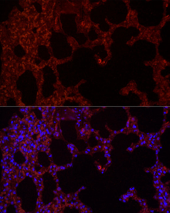 Immunofluorescence analysis of rat lung cells using NLRC4 Polyclonal antibody at dilution of 1:100 (40x lens). Blue: DAPI for nuclear staining.