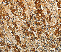 AKR1B1 Polyclonal Antibody - 3
