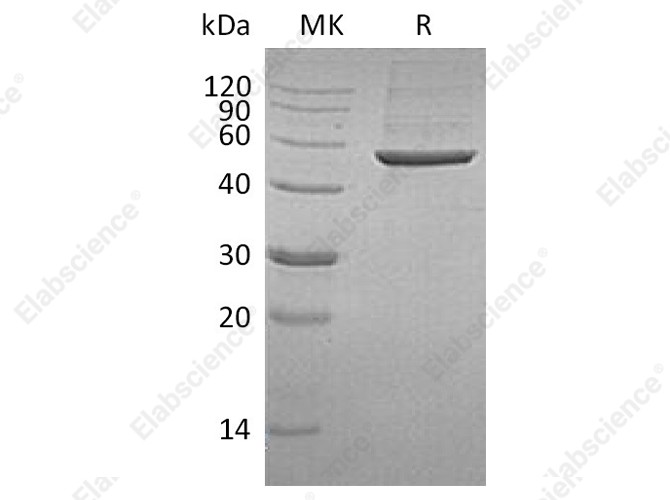 Recombinant Human PGD Protein (Human Cells, His Tag) - 1