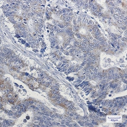 Recombinant NDUFB4 Monoclonal Antibody - 4
