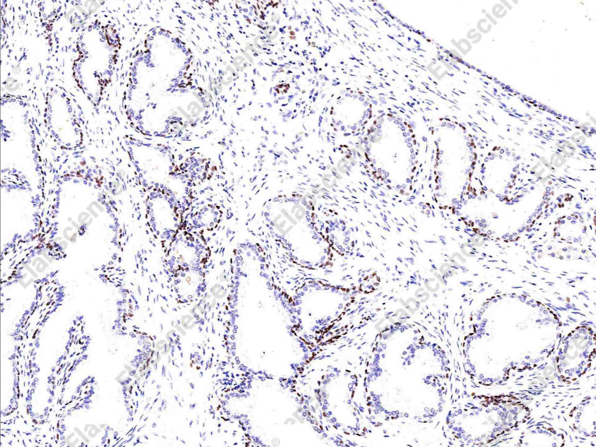 Recombinant p63(alpha) Monoclonal Antibody - 1