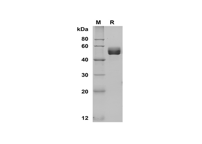 Recombinant Human CSF2 Protein-产品推荐-1