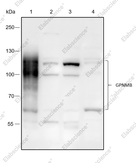 Recombinant GPNMB Monoclonal Antibody - 1