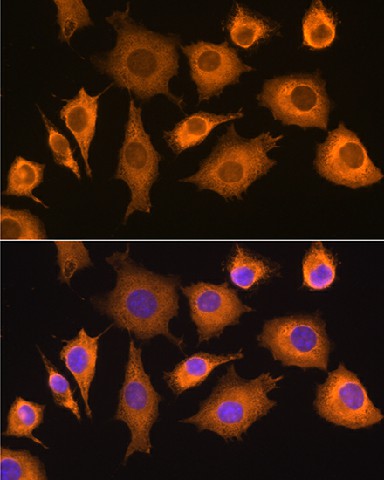 Immunofluorescence analysis of L929 cells using RIG-I / DDX58 Polyclonal Antibody at dilution of 1:100. Blue: DAPI for nuclear staining.