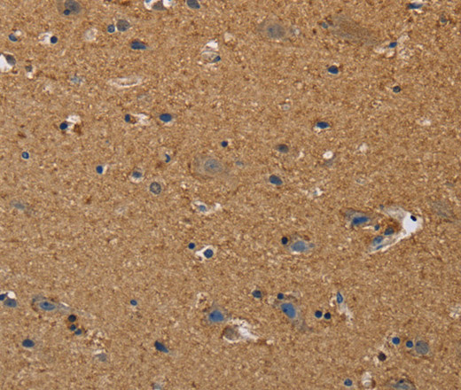 Immunohistochemistry of paraffin-embedded Human brain  using DDAH1 Polyclonal Antibody at dilution of 1:50