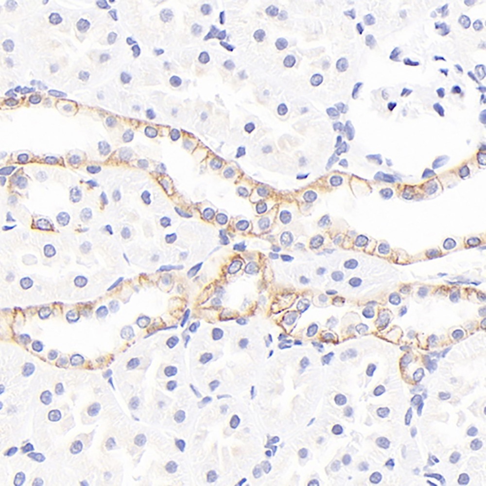 Immunohistochemistry analysis of paraffin-embedded rat kidney  using EPO Polyclonal Antibody at dilution of 1:600.