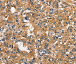 DNM2 Polyclonal Antibody - 3