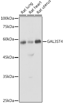 Western blot analysis of extracts of various cell lines using GAL3ST4 Polyclonal Antibody at 1:1000 dilution.