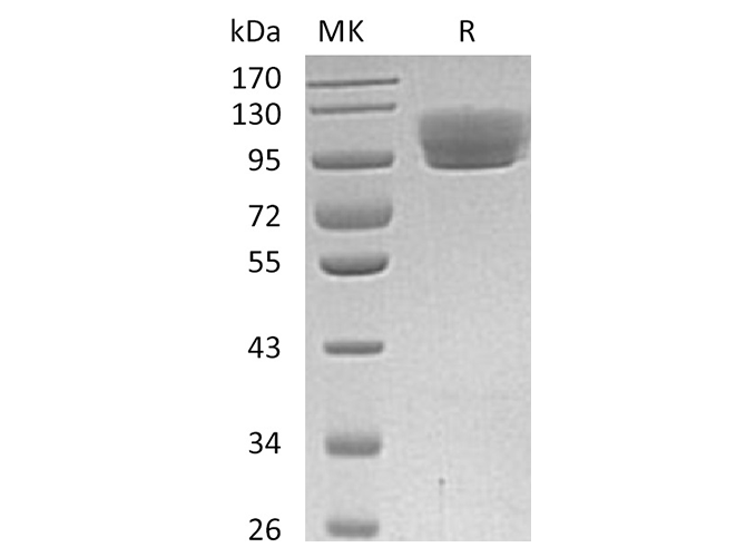 Recombinant Human ROBO4 Protein (Fc Tag)