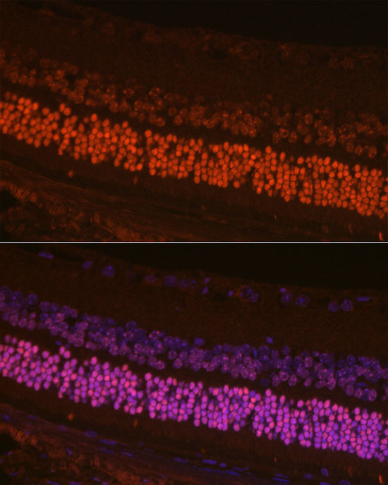 Immunofluorescence analysis of mouse retina cells using CRX Polyclonal Antibody at dilution of 1:200 (40x lens). Blue: DAPI for nuclear staining.