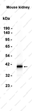 Recombinant Arg2 Monoclonal Antibody - 1
