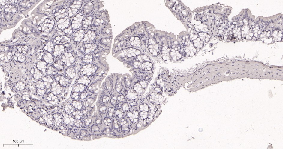 Recombinant Ki67 Monoclonal Antibody - small - 3