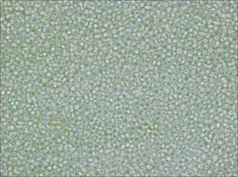 SU-DHL-4 Cell Complete Medium - 5