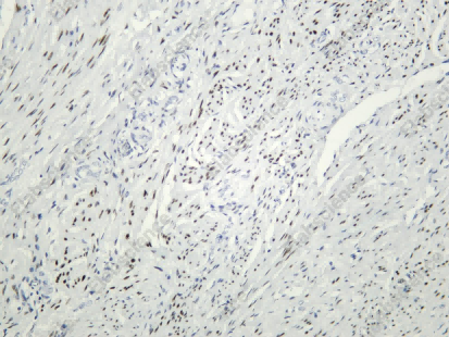 Recombinant Progesterone Receptor(PR) Monoclonal Antibody - 1