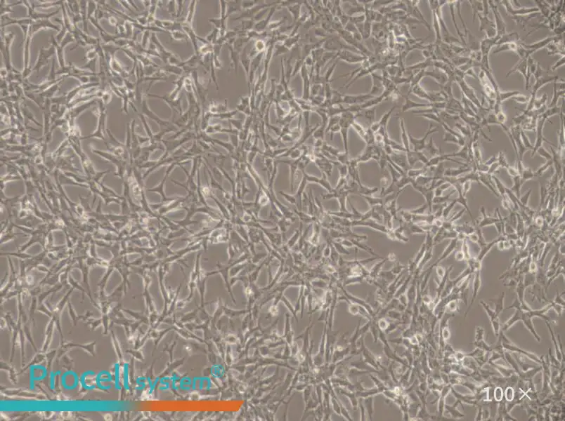 ES-2 Cell Complete Medium - 2