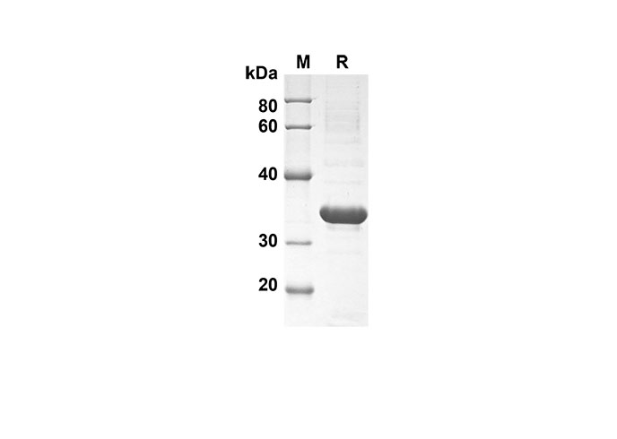 Recombinant Human CD30 Protein(Fc Tag)-产品推荐-1