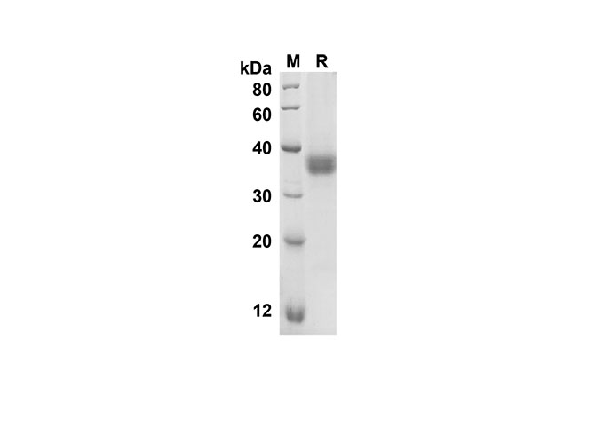 Recombinant Mouse RETN Protein(Trx Tag)-产品推荐-1
