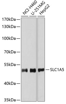 Western blot analysis of extracts of various cell lines using SLC1A5 Polyclonal Antibody at dilution of 1:3000.