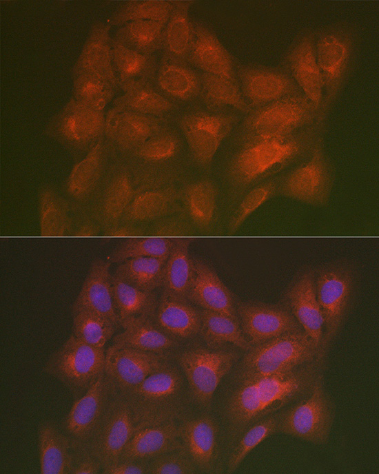 Immunofluorescence analysis of U2OS cells using LMAN2L Polyclonal Antibody at dilution of 1:200 (40x lens). Blue: DAPI for nuclear staining.