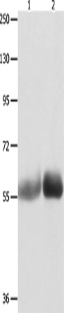 Western Blot analysis of Human liver cancer and stomach cancer tissue  using MUTYH Polyclonal Antibody at dilution of 1:1000