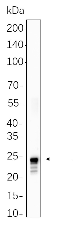 Recombinant Histone H2A (Ubiquityl Lys119) Monoclonal Antibody-searchlist-1
