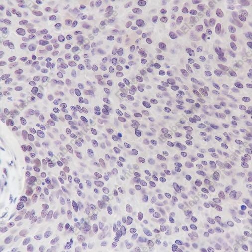 Recombinant Cyclin D3 Monoclonal Antibody - 3