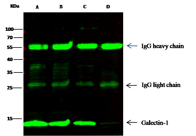 Recombinant Galectin-1/LGALS1 Monoclonal Antibody - small - 2