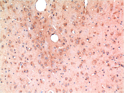 Immunohistochemistry of paraffin-embedded Rat brain tissue using TGFB1 Monoclonal Antibody at dilution of 1:200.